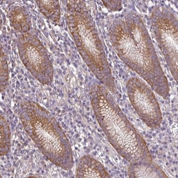 TrpC2-like protein Antibody, Novus Biologicals 0.1mL; Unlabeled:Antibodies,